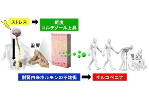 筋力・筋肉量の低下と副腎由来ホルモンの上昇に因果関係、九大が確認