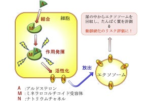 動脈硬化のリスクを尿の成分から評価できる可能性、阪大が確認