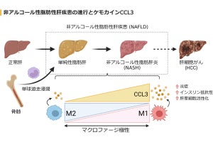 脂肪肝の進行に関与するタンパク質物質を金沢大が特定