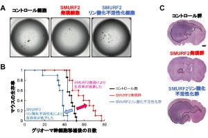 がん幹細胞の機能の制御に関わる新規創薬ターゲット、岐阜薬科大などが発見