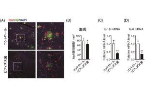 ビフィズス菌摂取でアルツハイマー病の記憶障害を予防、名市大がマウスで確認