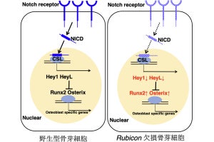 骨粗鬆症薬への応用も期待、オートファジーによる骨芽細胞の活性機構が解明