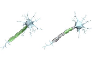 慢性的な手足や腰の痛みに関与する分子メカニズム、NCCHDなどが解明