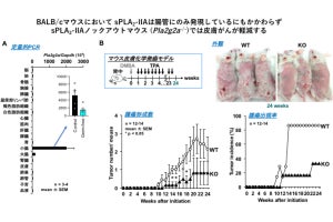 腸内細菌叢の変化が皮膚の疾患に影響を及ぼす可能性、東大などが発見