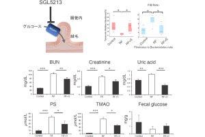 東北大、腸での糖の吸収を阻害することで糖尿病性腎臓病が改善することを確認
