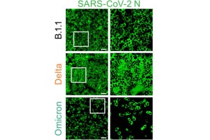 オミクロン株は病原性は低いがヒト集団内での増殖速度は高い、東大などが確認