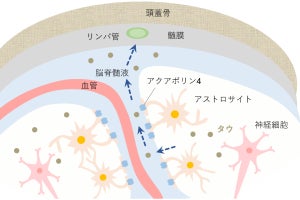 東大など、認知症の原因タンパク質「タウ」が脳から除去される仕組みを発見