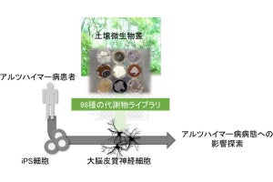 土壌の微生物がアルツハイマー病の病態に影響する可能性、京大などが確認