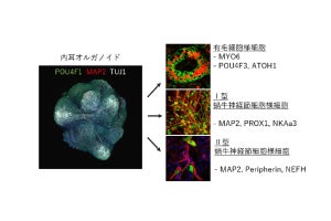 慈恵医大など、iPS細胞由来内耳オルガノイドを用いた薬剤性難聴の薬効評価系を確立