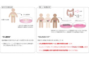 慶大が正常な大腸ミニ臓器の大量培養技術を開発、抗がん剤の効果予測などに期待