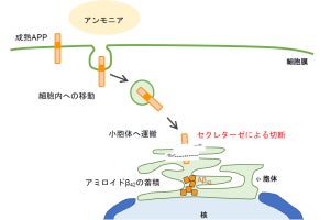 血中アンモニア濃度の上昇が脳内でアミロイドβの増加させる、新潟大が発見