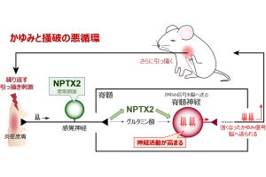 かゆい皮膚を引っ掻くとかゆみ信号伝達物質の活動が高まることを九大などが発見