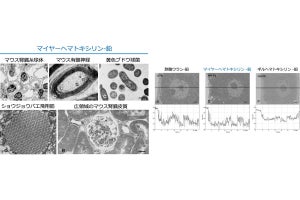 東京保健医療専門職大など、従来の酢酸ウランに代わる電顕用染色法を開発