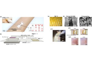 貼るだけで高感度に新型コロナ感染を診断できるデバイス、東大生研が開発