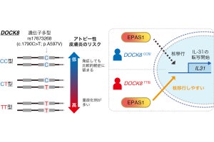 九大、アトピー性皮膚炎の発症と重症化に関与する遺伝子多型を発見