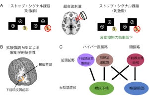 順天堂大、不適切な行動の抑制に関与する前頭葉-被殻という脳の回路を発見