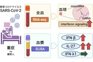 新型コロナ肺炎患者はインターフェロンシグナルが活性化している、阪大が確認