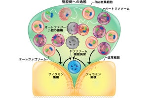 理科大、オートファジーが細胞競合を介してがん細胞を排除することを発見