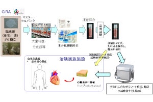 順天堂大、虚血性心筋症へのiPS細胞由来心筋細胞シート移植を実施