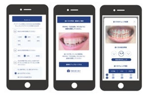 ライオン、アプリによる口腔ケア意識の向上と健康習慣の定着支援を促進