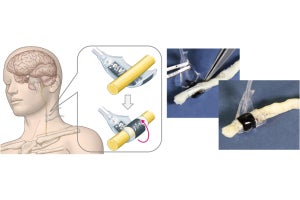 東北大、神経に柔らかく巻き付いて密着固定を維持できる神経刺激ゲル電極を開発