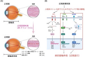 慶大、近視を点眼で治療できる可能性のある化合物をマウスによる実験で発見