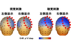 東工大、空間への注意に対する右脳優位性に脳部位「島皮質」の関連を発見