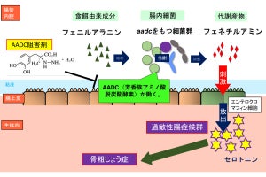 腸内細菌により骨粗しょう症や過敏性腸症候群が発症する可能性、近大など