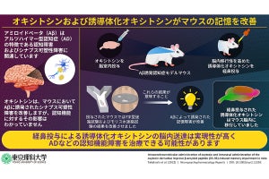 オキシトシン経鼻投与でアルツハイマー型認知症の行動障害改善、理科大がマウスで確認