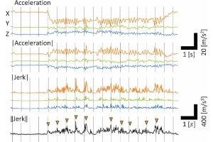 ラットもヒトと同じ脳のメカニズムで音楽に同期する、東大が発見