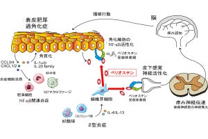 アトピー性皮膚炎の痒みの原因が判明、治療薬の効果を動物実験で確認　富山大など