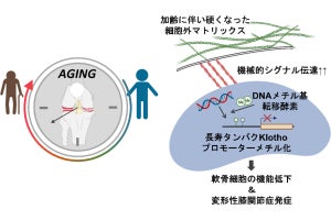 名大などが変形性膝関節症の発症メカニズムを解明、病態解明や治療法開発に期待