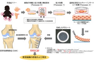 東海大、膝の軟骨欠損部に移植可能な「同種軟骨細胞シート」を開発