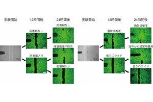 皮膚の傷修復には細胞へのクロライドイオンの流入が重要　生理研などが解明