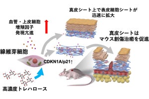 愛媛大、高濃度トレハロースを用いて3次元培養真皮シートの作成に成功