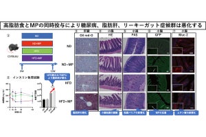 マイクロプラスチックは高脂肪食下で異常を誘発　京都府立医科大などが確認