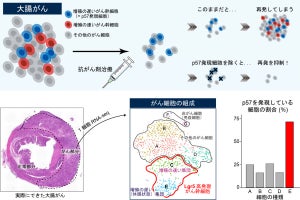 大腸がん再発の原因となるがん幹細胞を九大が発見　再発を防ぐ治療法に期待