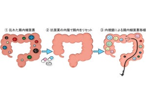 順大など、先進医療として第1例目となる腸内細菌叢移植の実施を発表