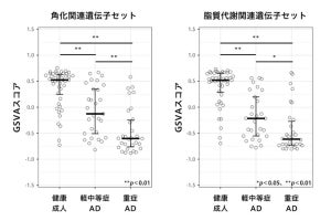 皮脂RNAからアトピー性皮膚炎の重症度を評価できる可能性、花王などが発表