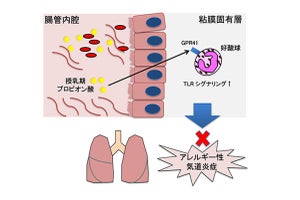 授乳期の短鎖脂肪酸が子どもの気管支喘息を改善する可能性、理研などが発表