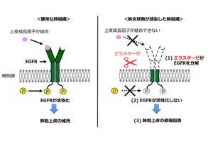 肺炎が難治化する仕組みを新潟大が解明、治癒力を回復させる方法も考案