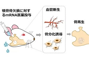 東京医科歯科大が顎骨欠損の再生治療に成功　mRNA医薬の活用に新展開