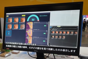 両備システムズがAIで胃がん治療方法を判断する技術を展示、モダンホスピタルショウ2023