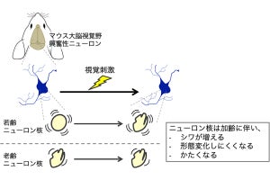 脳の老化の原因はニューロンの核が加齢で硬くなること？　東大が確認