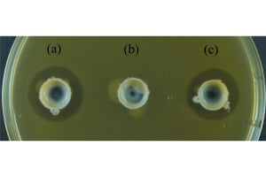 東薬大がアクネ菌の増殖を抑える物質を発見　新たなニキビ治療薬開発に光