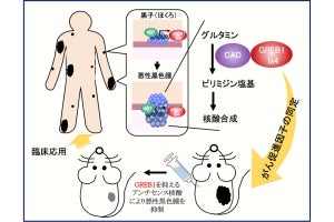 阪大、皮膚がん「悪性黒色腫」の治療のための新たな分子標的を発見