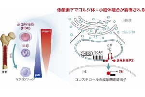 東大、オルガネラを介した免疫制御機構ががんの進展に関与することを発見