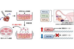 理研など、予後不良の卵巣がん「HGSOC」の発がんメカニズムを解明