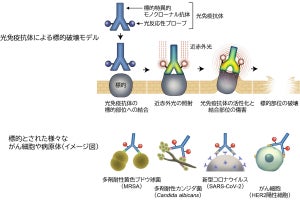 慈恵医大など、がん細胞や病原体だけを狙い撃てる「光免疫療治療法」を確立