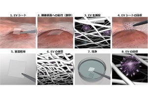 名大など、卵巣がんの腹水中から細胞外小胞を回収するCNF製シートを開発